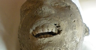 dientes habitantes Pompeya